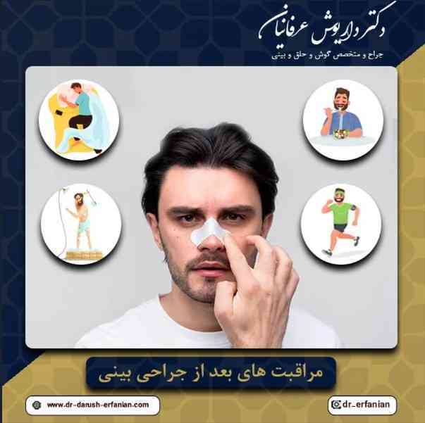 مراقبت های بعد از جراحی بینی