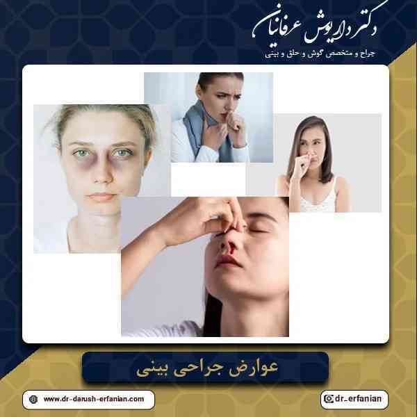 عوارض جراحی بینی