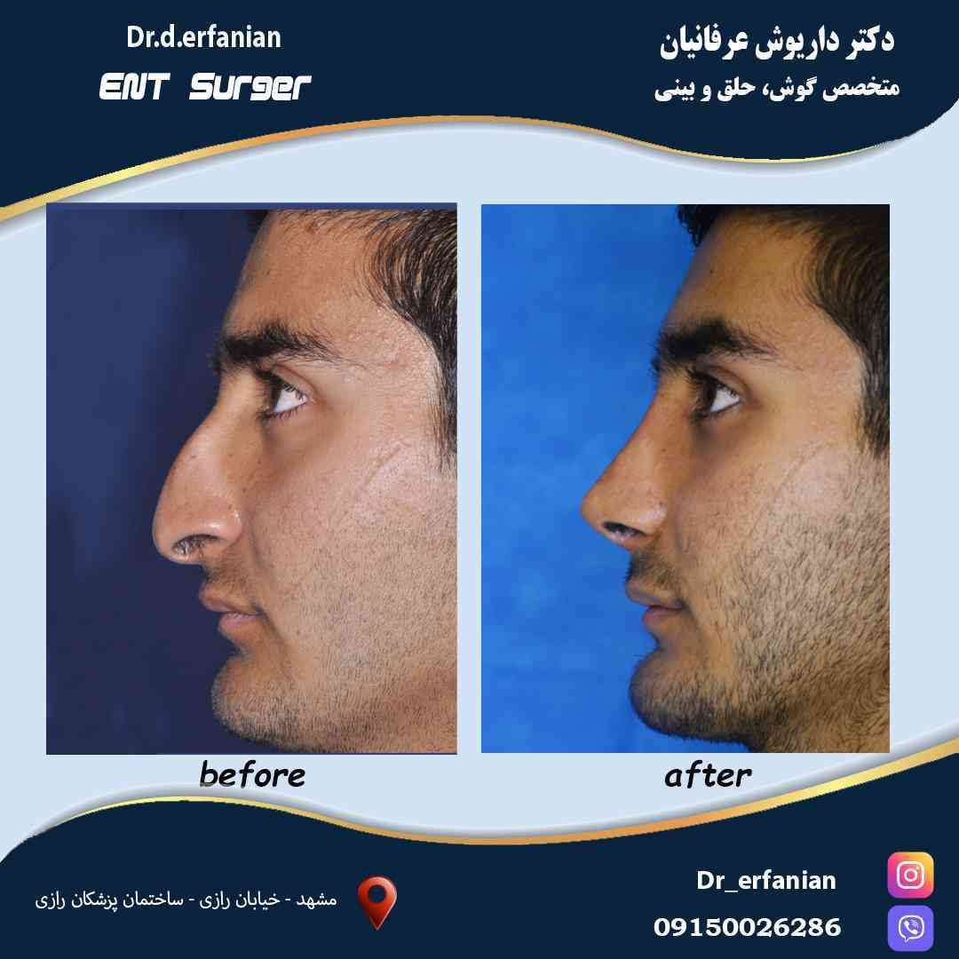 عمل بینی آقای محمدی