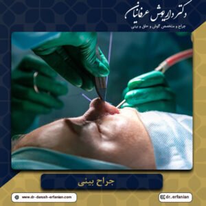 جراح بینی