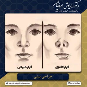 جراحی بینی