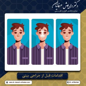 اقدامات قبل از جراحی بینی