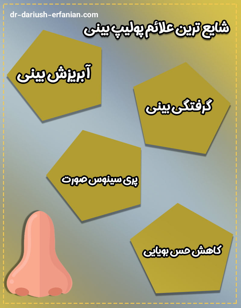 نشانه های پولیپ بینی - دکتر عرفانیان